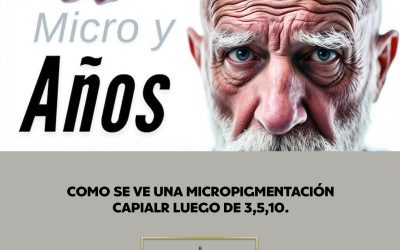 Cómo se ve una micropigmentación capilar después de 3, 5 o 10 años