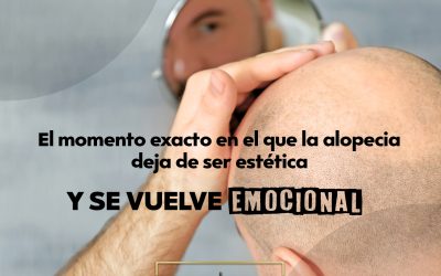 El momento exacto en el que la alopecia deja de ser estética y se vuelve emocional
