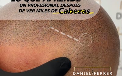 Lo que aprende un profesional después de observar miles de cabezas
