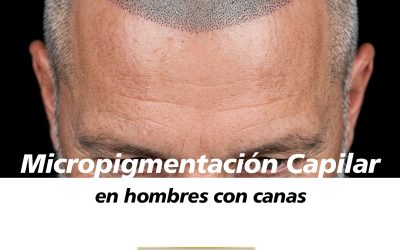 Micropigmentación capilar en hombres con canas: ¿se puede conseguir un resultado natural?