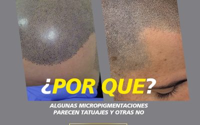 ¿Por qué algunas micropigmentaciones capilares parecen un tatuaje y otras parecen pelo real?
