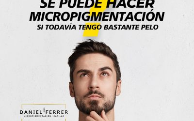 ¿Se puede hacer micropigmentación capilar si todavía tienes bastante pelo?